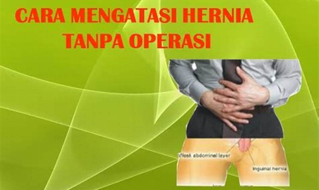 Cara Mengatasi Hernia: Petunjuk Lengkap Cara Mengatasi Hernia: Petunjuk Lengkap